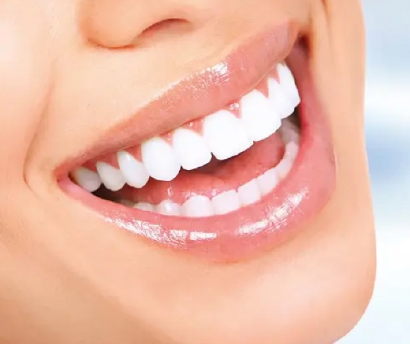 Blanchiment dentaire