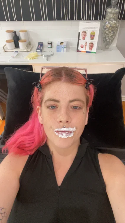 Lip filler 