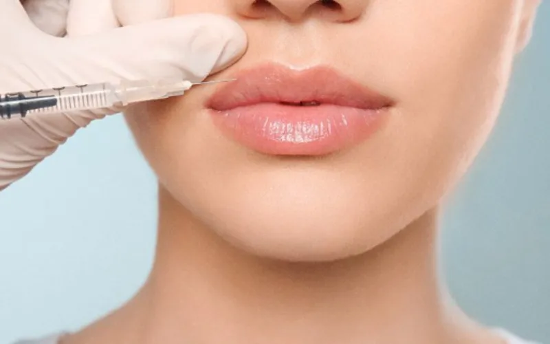 Lip injections