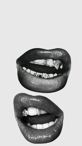 Braces! Braces! Braces! 