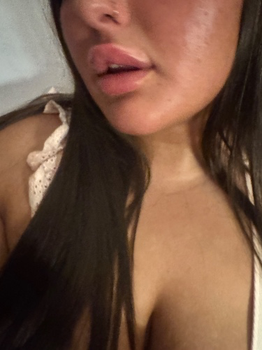 My lips & Botox needs reimbursing 