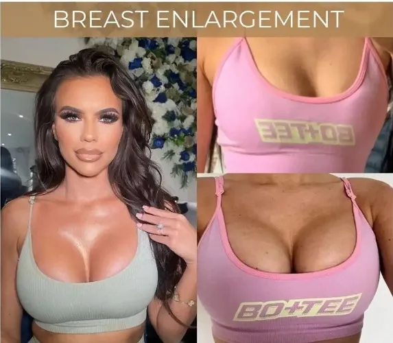 Breast Enlargement London | Breast Augmentation & Boob Job Surgery