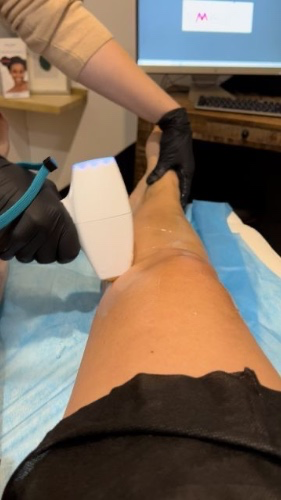 hair removal maintenance