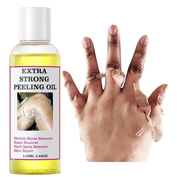 Peeling Oil for Dark Skin, Yellow Peeling Oil, Extra Strong Peeling Oil, Exfoliating Peeling Solution for Body All Skin Type -110ML/3.88 OZ