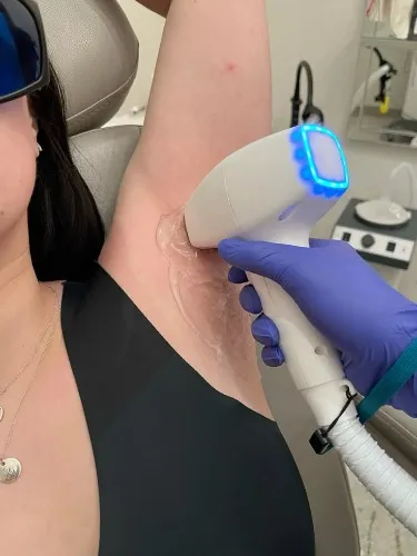 Laser hair removal 