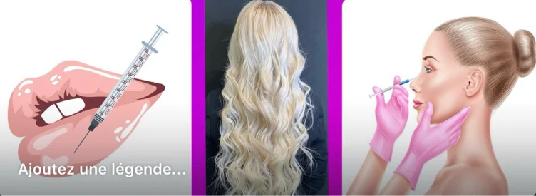 Bigger Lips 👄 + Botox 💉 + Hair Extensions