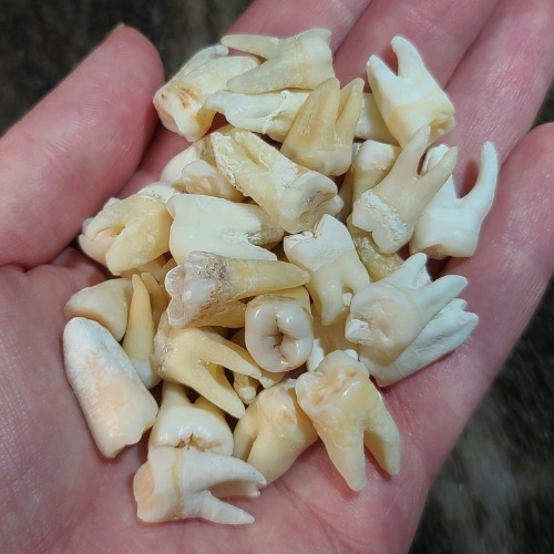 Human Teeth, Molars | Default Title