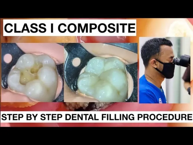 Dental Filling