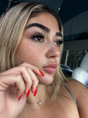 $800 Lip Filler 💉👄 