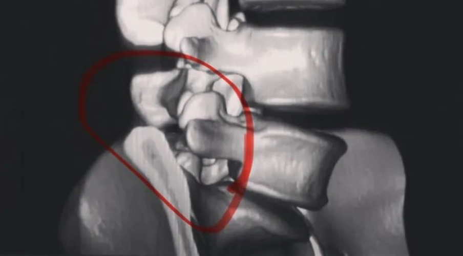 Massage therapy for my back 🩷