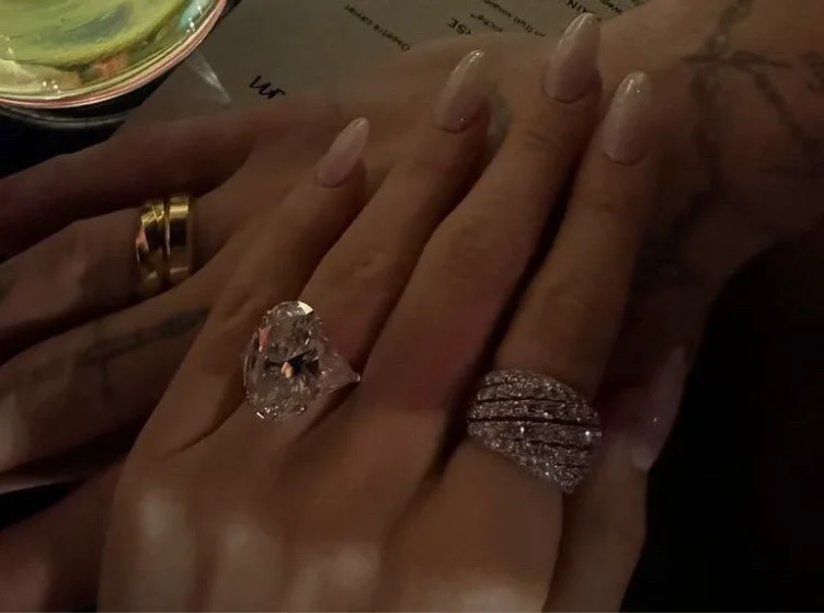 Spa day har nails botox