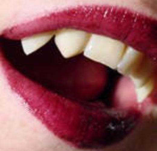 Etsy - Double Set Fangs