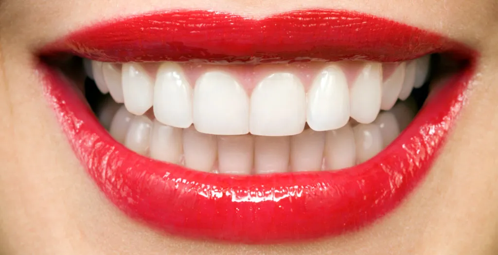 Hollywood smile