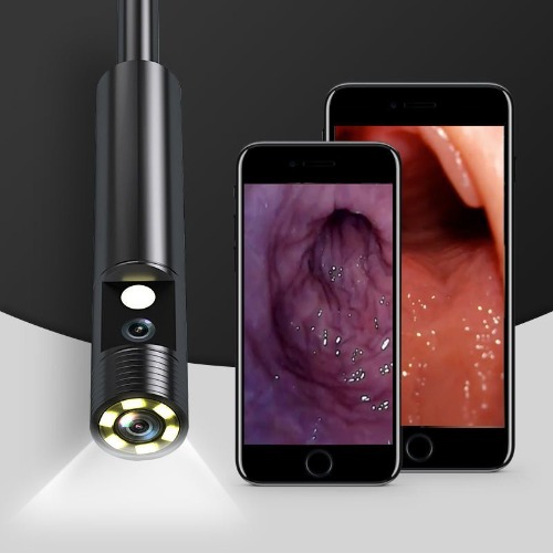 Vagina / Anal Camera - Dual lighted Lenses / Endoscope | Default Title