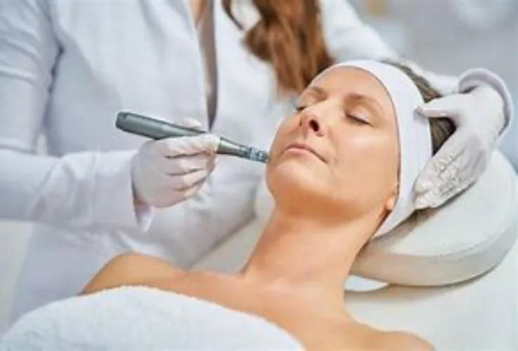 Microneedling w/ PRP