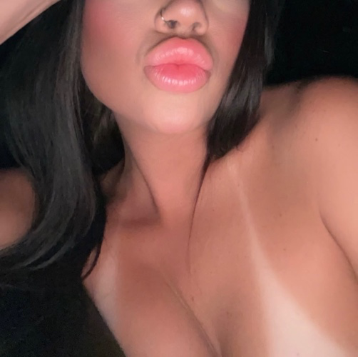 Botox/Filler