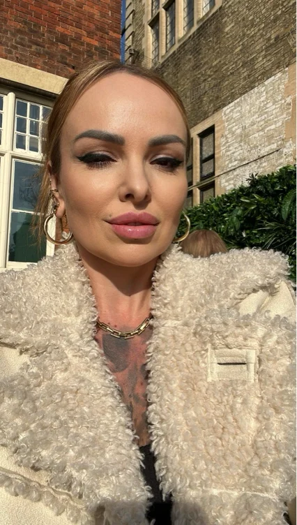 Lip filler or facial ✨😍💕