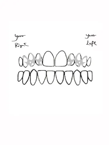 Dream Mouth Custom Teeth Jewelry