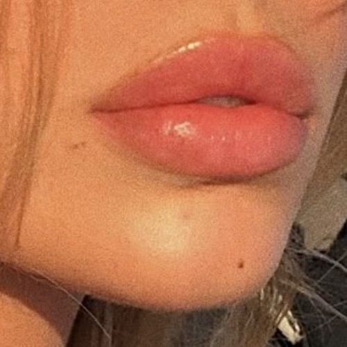 ♡ lips filler ♡
