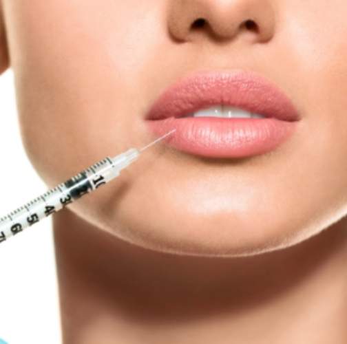 Lip Filler 