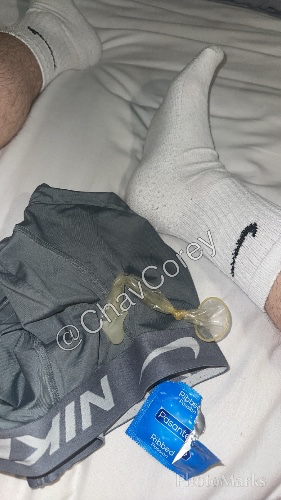 (DM FIRST) Filled C*ndom