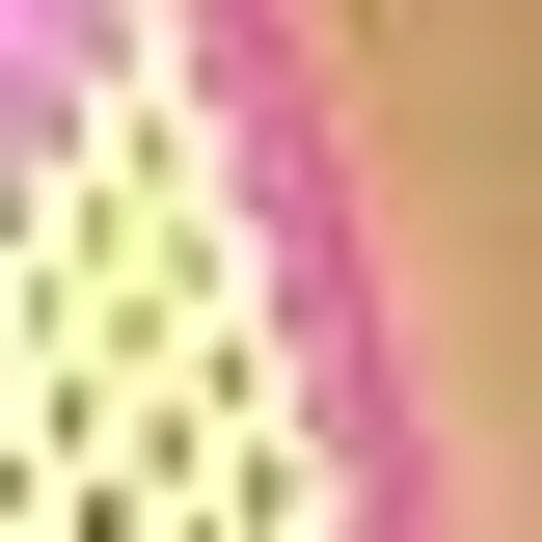 Women's Neon Yellow w Pink Exotic Euro Extreme Bikini w Micro G Thong and Underboob