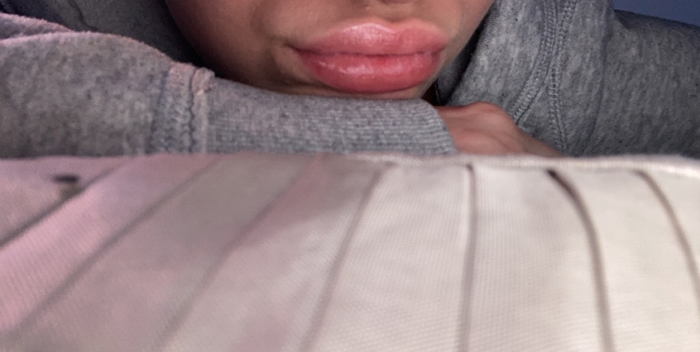Lips