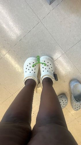 Crocs Reimbursement 