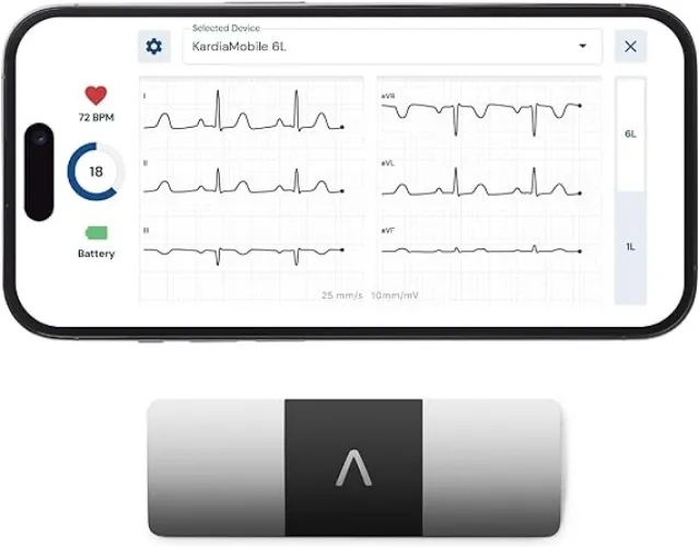 KardiaMobile 6-Lead Personal ECG Monitor - Six Views of The Heart - Detects AF and Irregular Arrhythmias - Instant Results in 30 Seconds - Works with Most Smartphones