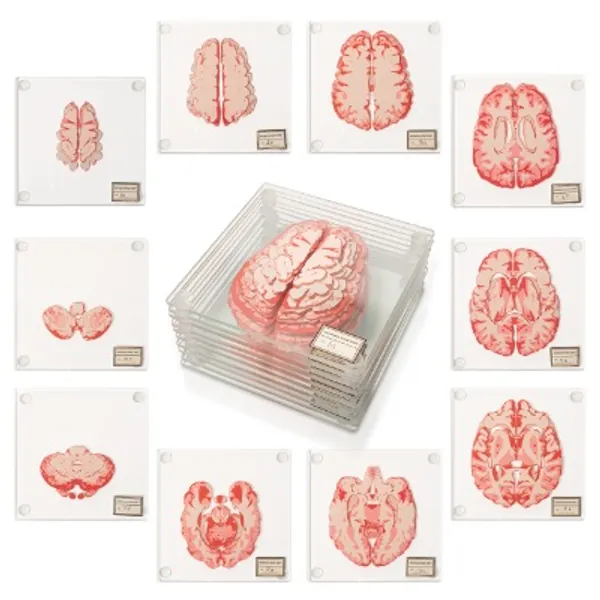 Anatomic Brain Specimen Coasters (Set of 10) - Neuroscience Gifts, Gifts for Medical Student Gifts Brain Decor Human Anatomy Gifts