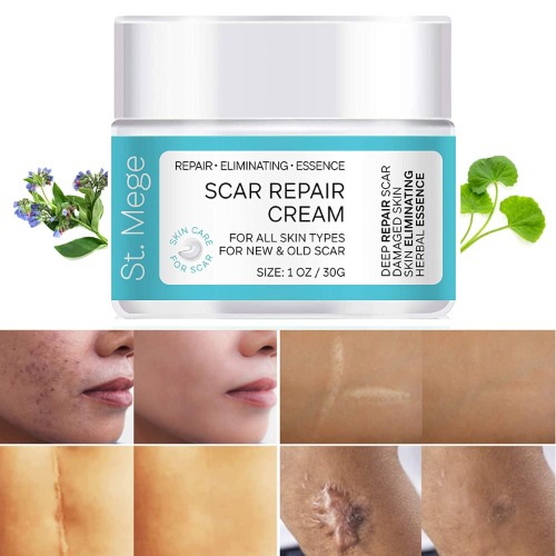 Scar Removal Cream, Scar Cream For Old Scars - Stretch Mark Removal Cream for Men & Women - Stretch Marks Relief and Burns Repair, Face Skin Repair Cream - 1 Ounce (Pack of 1)