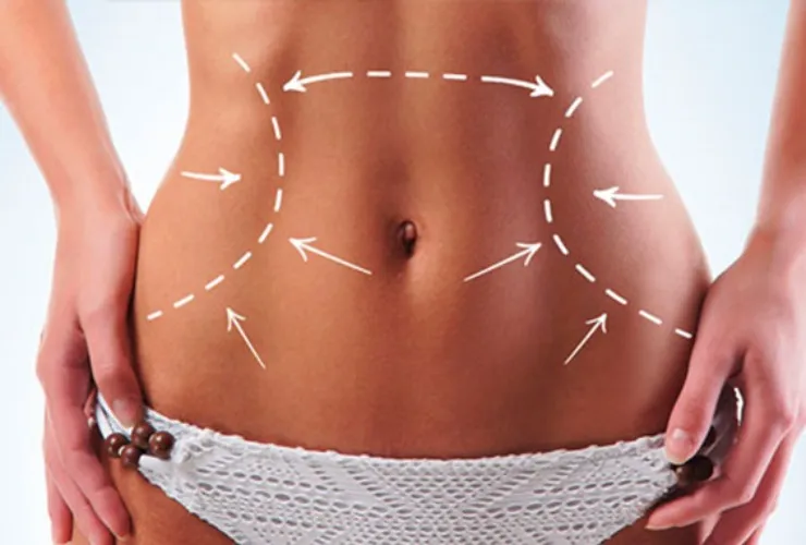 A new surgery to see me like a vampire